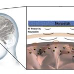 Neurograin Microchips Brain Implant Cerebral Cortex. Mind-Reader AI / ML